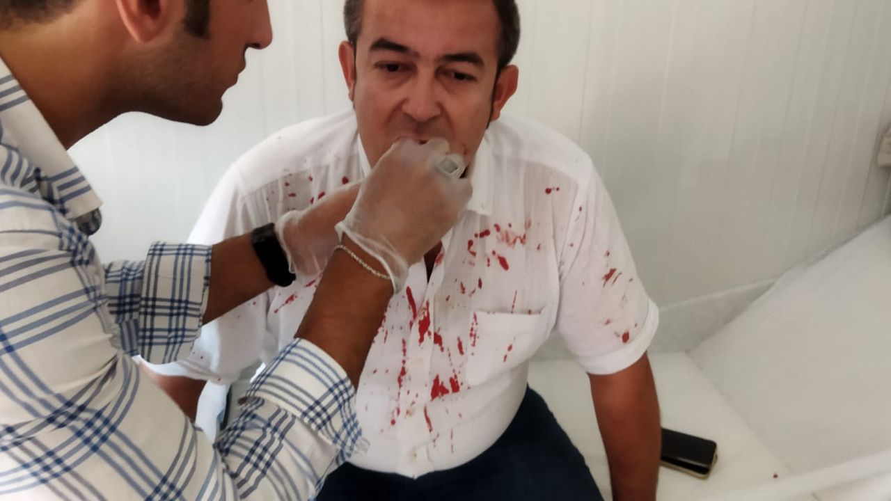 ÇGC’den AHaber muhabiri Halil İbrahim Uğur’a yapılan saldırı girişimine tepki…