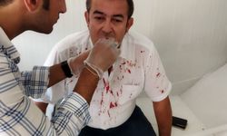 ÇGC’den AHaber muhabiri Halil İbrahim Uğur’a yapılan saldırı girişimine tepki…