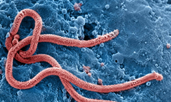 DSÖ Alarm Verdi: Kongo ve Uganda’daki Ebola Salgınında 130 Şüpheli Ölüm, 500’den Fazla Şüpheli Vaka