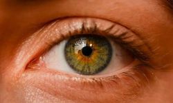 Eye Color Change Turkey Aramalarında Doğru Uzman Seçimi