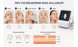HIFU Yüz Bölgesinde Nasıl Kullanılır? Uygulama Süreci ve Dikkat Edilmesi Gerekenler