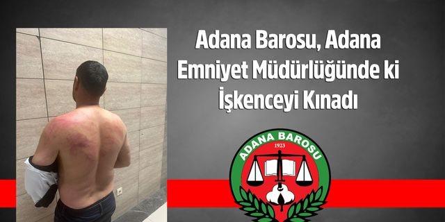 Adana Barosu, Adana Emniyet Müdürlüğünde ki İşkenceyi Kınadı