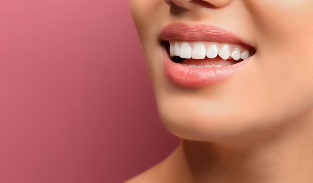Diş Beyazlatma İşlemi Ne Kadar Sürede Bir Yapılmalıdır