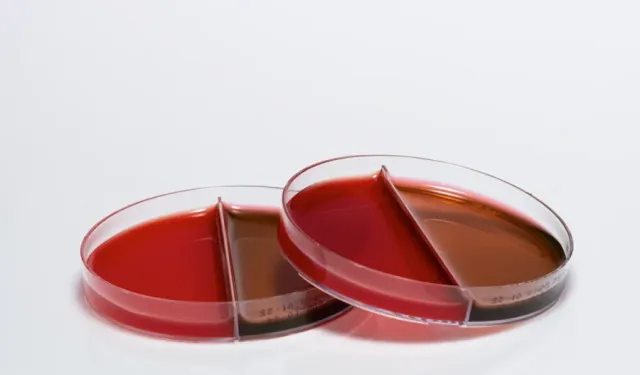 Mikrobiyolojide Güvenilir Bir Adım: Kanlı Agar ve Medexia Çözümleri