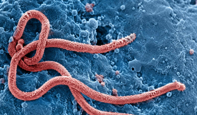 DSÖ Alarm Verdi: Kongo ve Uganda’daki Ebola Salgınında 130 Şüpheli Ölüm, 500’den Fazla Şüpheli Vaka