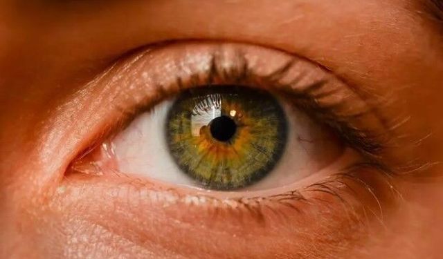 Eye Color Change Turkey Aramalarında Doğru Uzman Seçimi