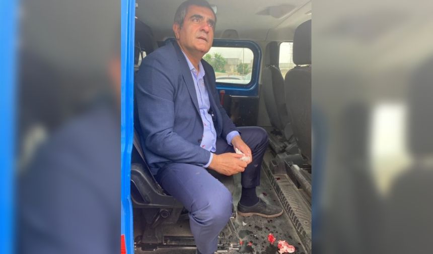 Şanlıurfa'da CHP Milletvekili Ali Şeker darp edildi.