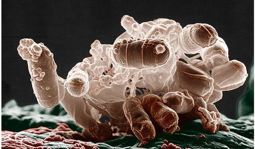 Antibiyotiklere dair çarpıcı araştırma: Enfeksiyonu tedavi ederken iltihabı artırabilir mi?